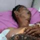 Peternak Udang di OKI Diterkam Buaya, Tangan Kanan Terputus
