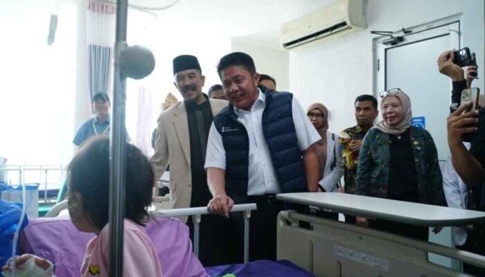 Peringkat Kedua Tertinggi di Indonesia, Kasus Bibir Sumbing di Sumatera Selatan Didominasi Warga OKI