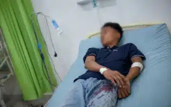 Korban Dugaan Penembakan di Kayuagung Dirujuk ke Palembang, Polisi Buru Pelaku