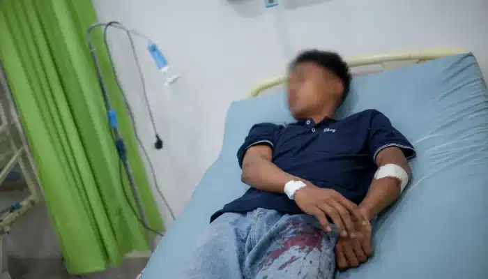 Korban Dugaan Penembakan di Kayuagung Dirujuk ke Palembang, Polisi Buru Pelaku